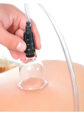 Beginner’s 6 pc. Cupping Set